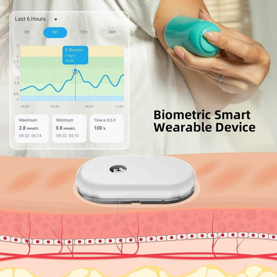 SiBio KS1 Continuous Ketone Monitoring System (CKM) - Special Bulk Purchase Offers - SiBio